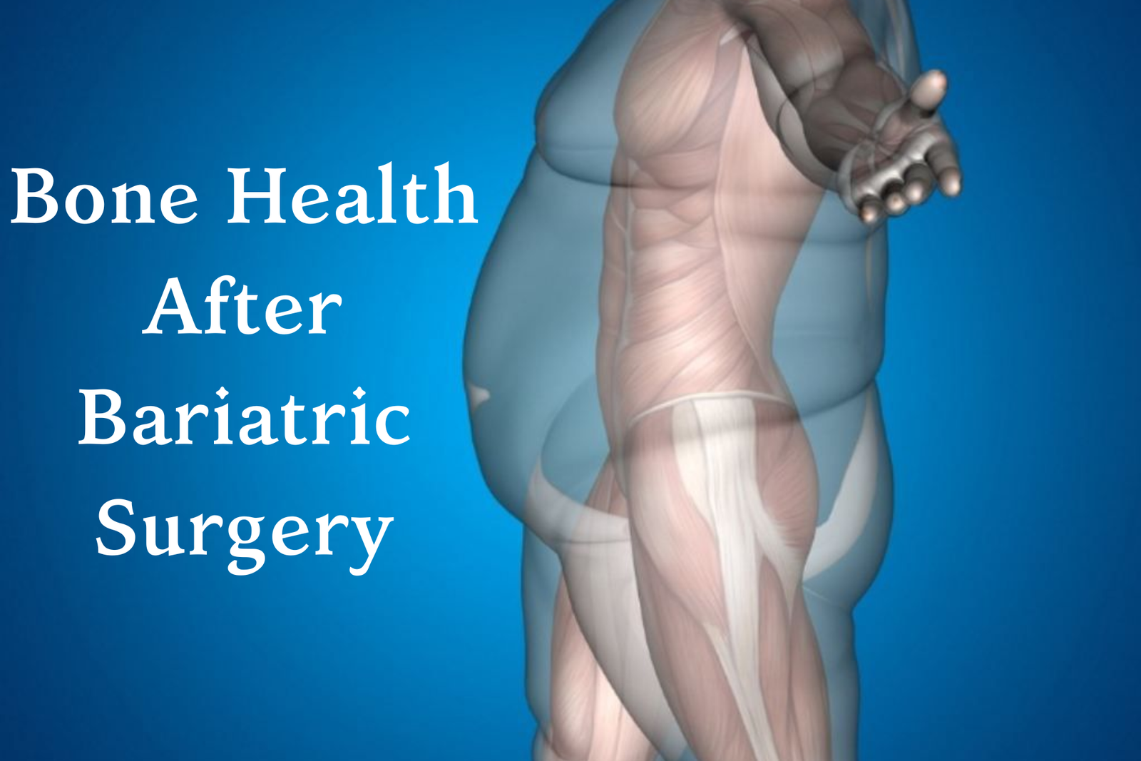 Bone Health after bariatric surgery