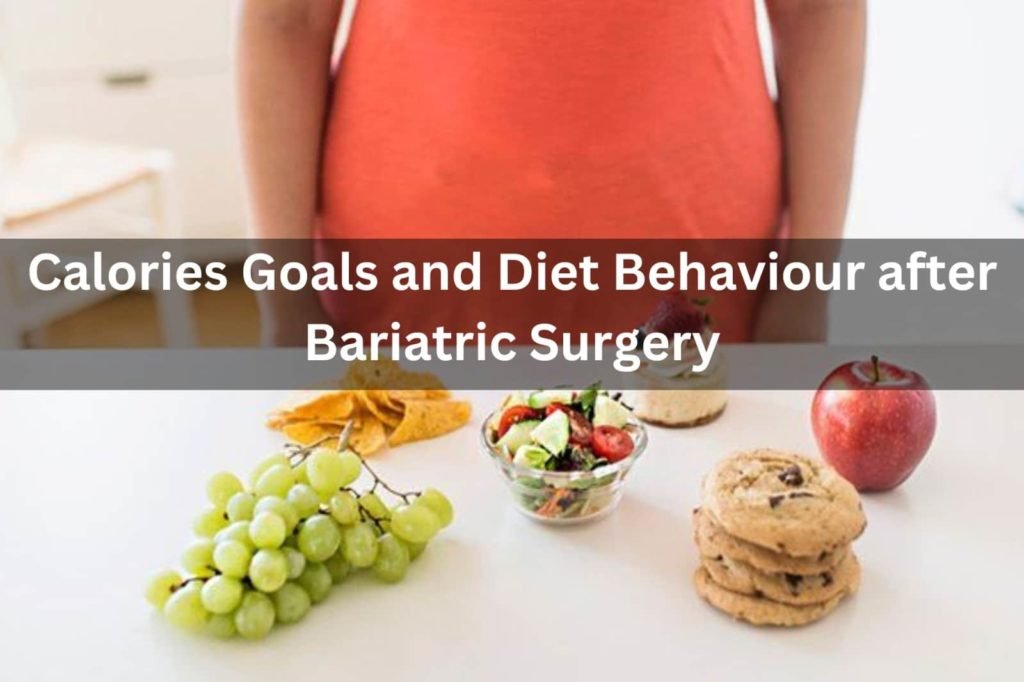 Calories Goals And Diet Behaviour After Bariatric Surgery in indore-Indore Laparoscopy Center