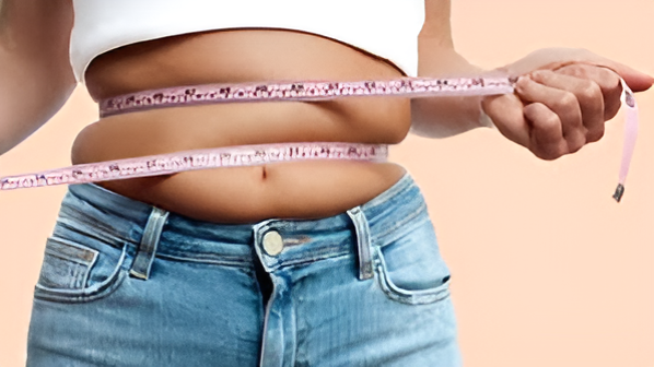 Weight Loss Surgery