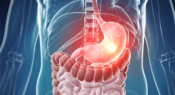 gastric bypass