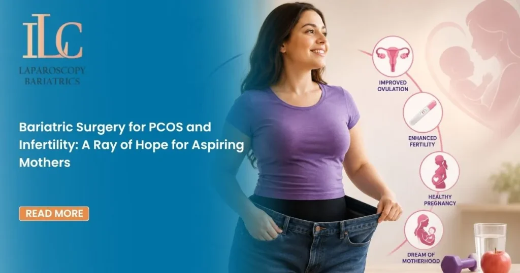 Bariatric Surgery for PCOS and Infertility A Ray of Hope for Aspiring Mothers
