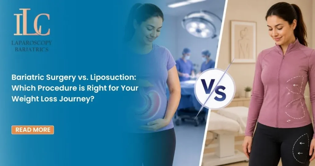 Bariatric Surgery vs. Liposuction Which Procedure is Right for Your Weight Loss Journey