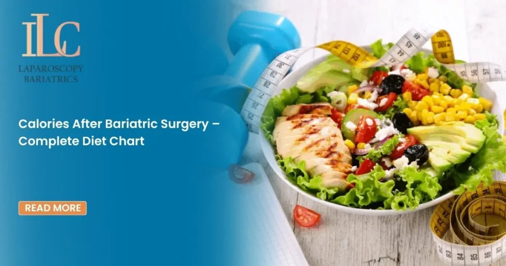 Calories After Bariatric Surgery – Complete Diet Chart
