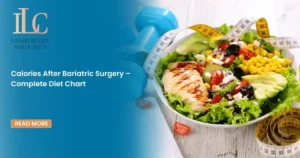 Calories After Bariatric Surgery – Complete Diet Chart