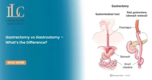 Gastrectomy vs Gastrostomy – What’s the Difference