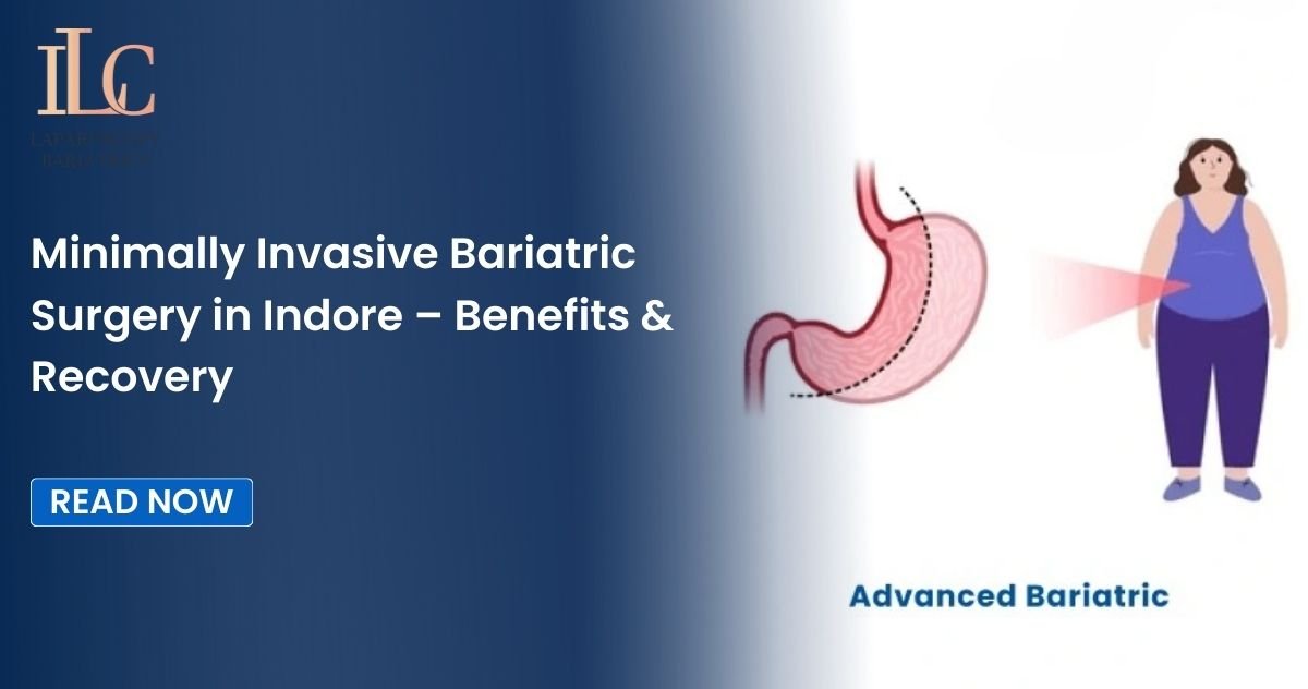 Minimally Invasive Bariatric Surgery in Indore – Benefits & Recovery