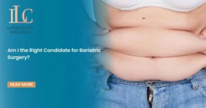 Am I the Right Candidate for Bariatric Surgery