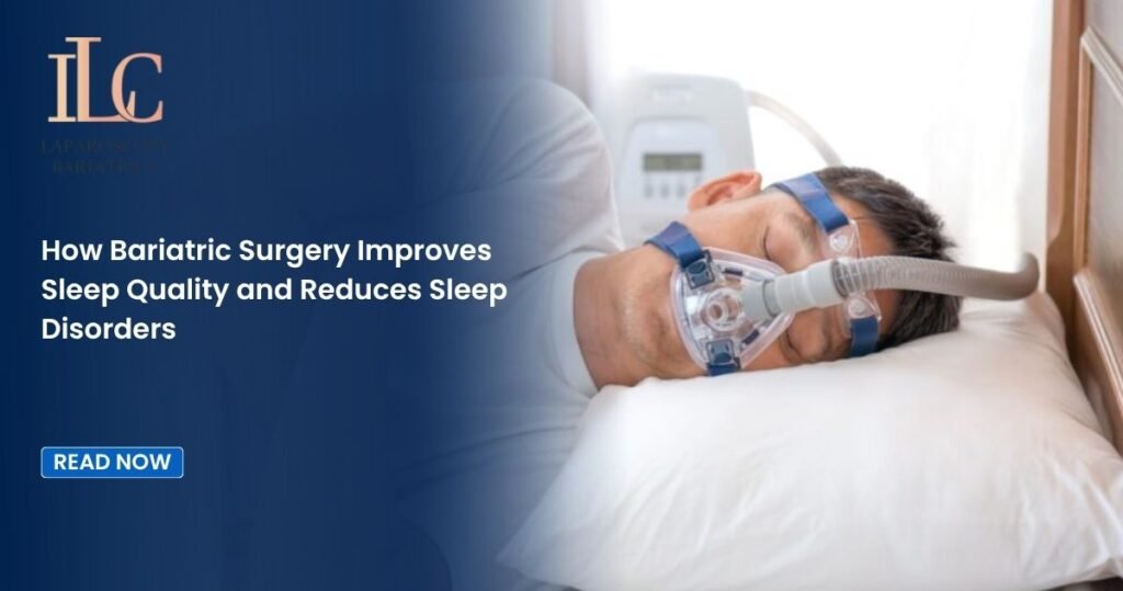 How Bariatric Surgery Improves Sleep Quality and Reduces Sleep Disorders