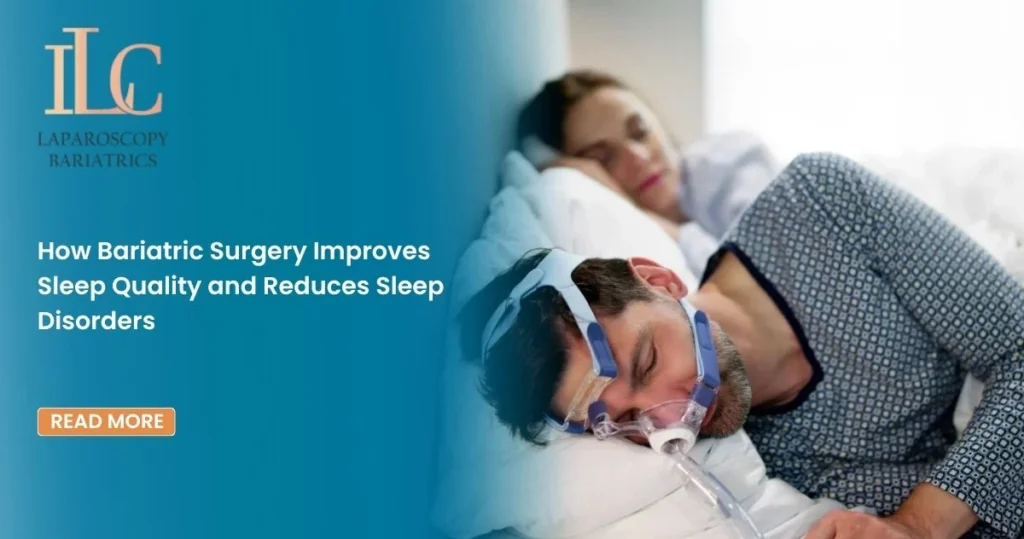 How Bariatric Surgery Improves Sleep Quality and Reduces Sleep Disorders