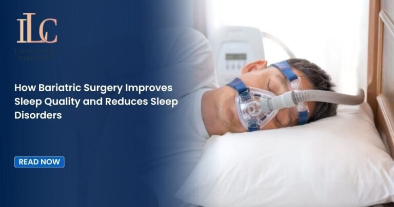 How Bariatric Surgery Improves Sleep Quality and Reduces Sleep Disorders