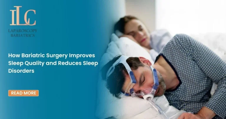 How Bariatric Surgery Improves Sleep Quality and Reduces Sleep Disorders