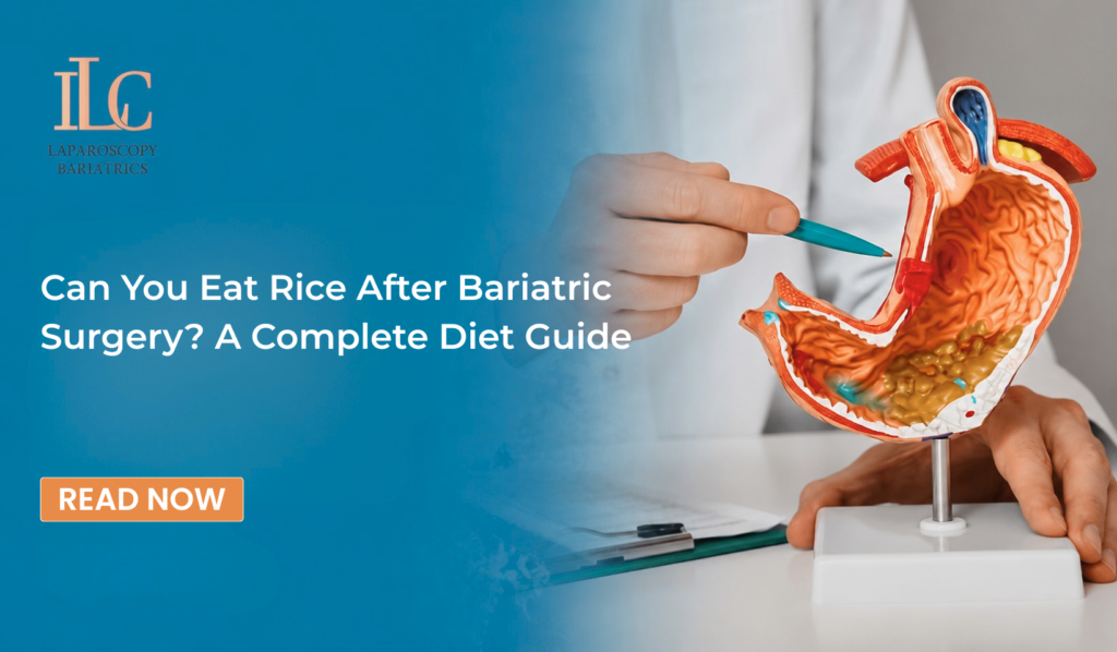 Can You Eat Rice After Bariatric Surgery? A Complete Diet Guide