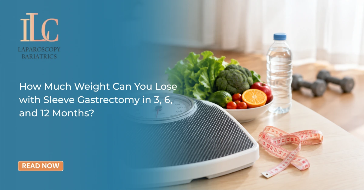 How Much Weight Can You Lose with Sleeve Gastrectomy in 3, 6, and 12 Months?